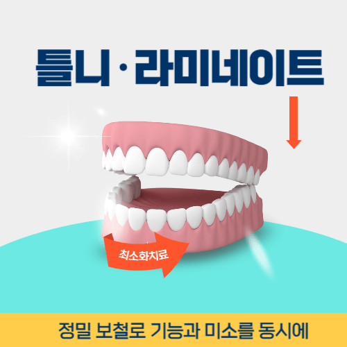 거제치과 거제시 치과 틀니 라미네이트