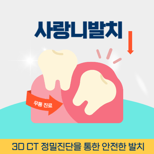 거제치과 거제시 치과 사랑니 발치