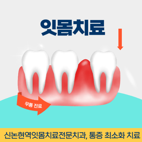 거제치과 거제시 치과 잇몸치료